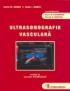 Ultrasonografie vasculara